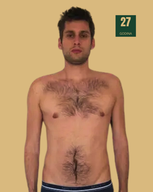 Karusel-Moja-transformacija-aero-u-hibrid-2